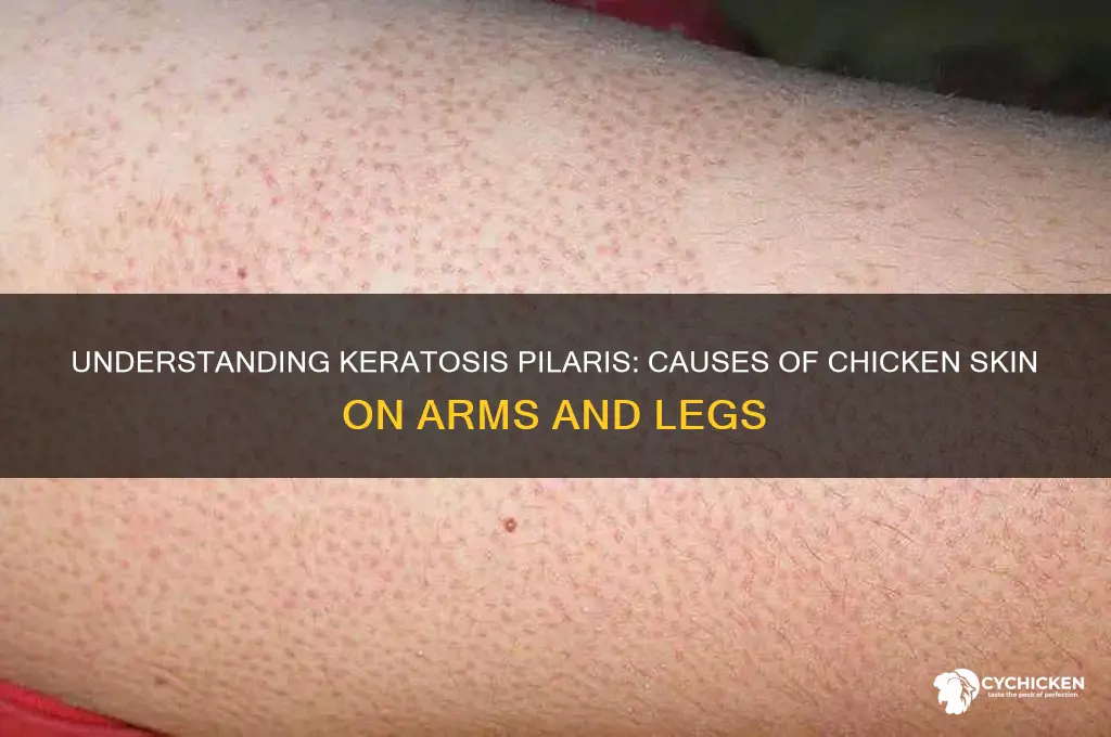 what causes chicken skin on arms and legs