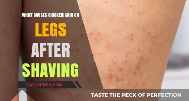 Why Shaving Causes Chicken Skin on Legs: Causes and Solutions