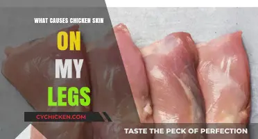 Understanding Keratosis Pilaris: Causes of Chicken Skin on Legs