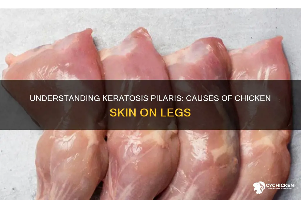 what causes chicken skin on my legs