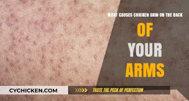 Understanding Keratosis Pilaris and Its Causes