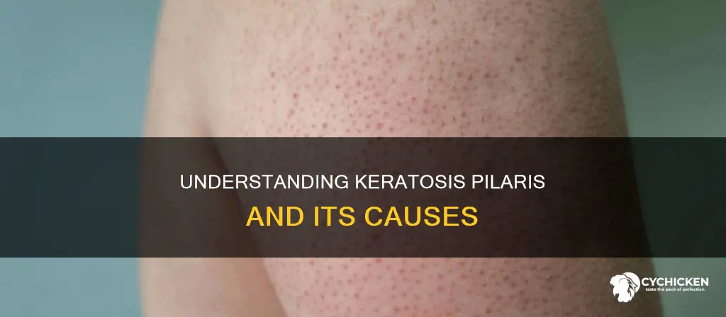 what causes chicken skin on the back of your arms