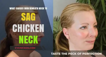 Neck Skin Sag: Why the Turkey Waddle?