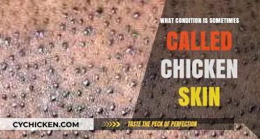 Understanding Keratosis Pilaris: The 'Chicken Skin' Condition Explained