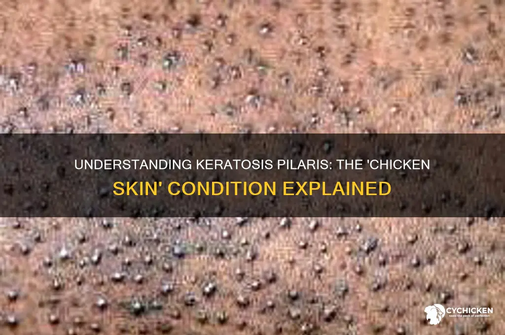what condition is sometimes called chicken skin