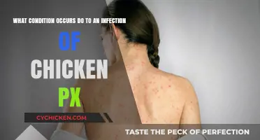 Chickenpox Infection: Understanding the Underlying Condition
