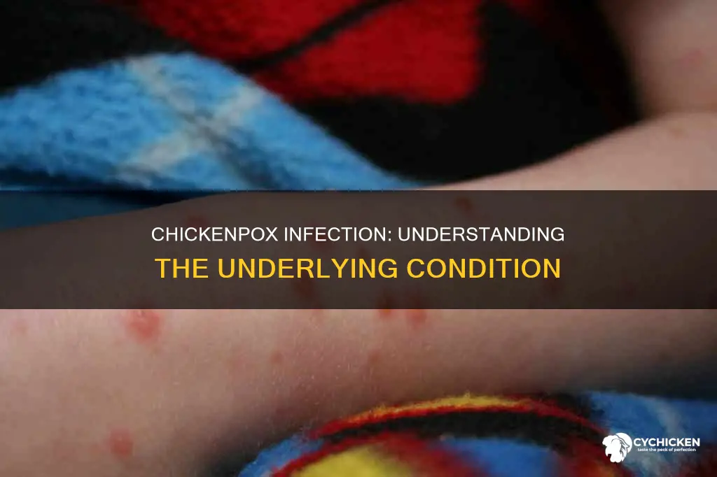 what condition occurs do to an infection of chicken px