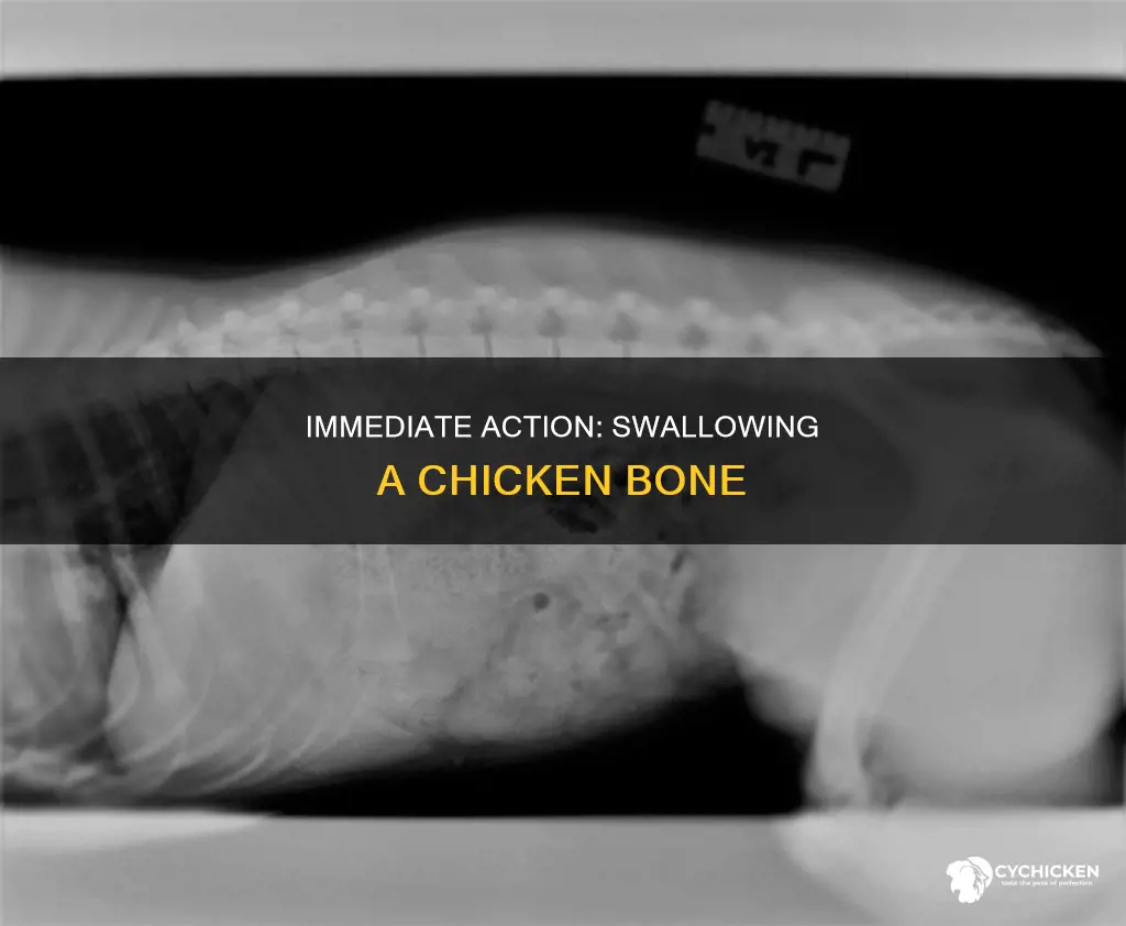 what do i do if i swallow a chicken bone