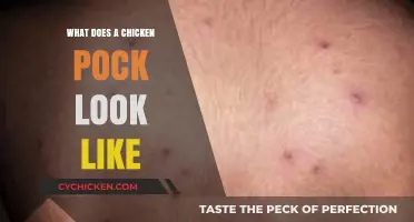 Unveiling the Mystery: What Does a Chickenpox Look Like?
