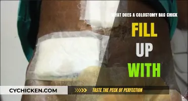 Colostomy Bag: What's the Fill-Up Process?