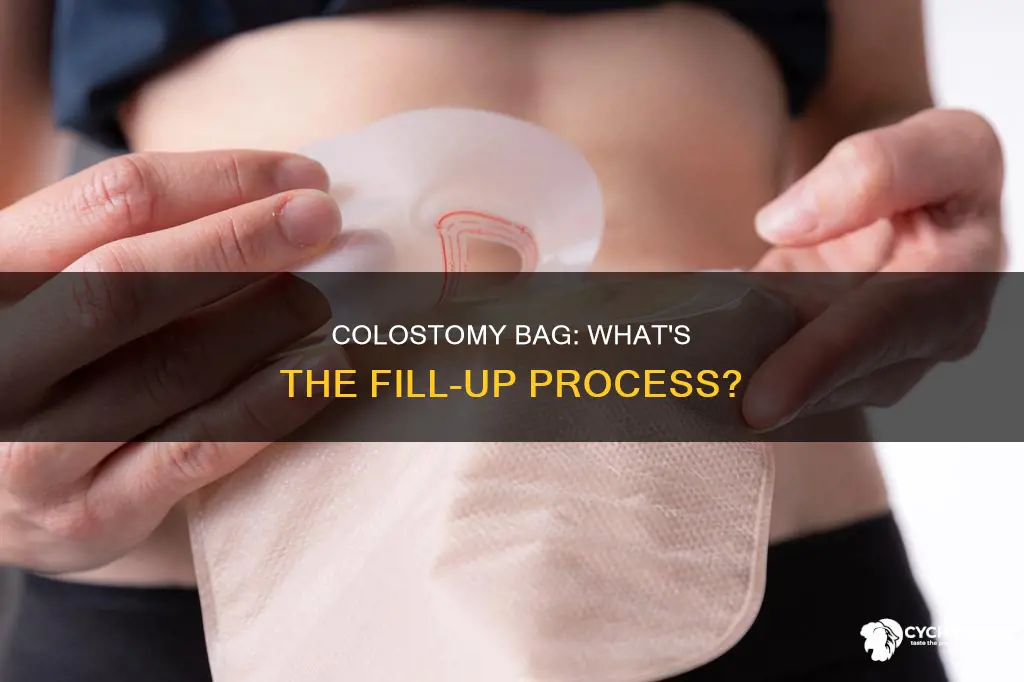what does a colostomy bag chick fill up with