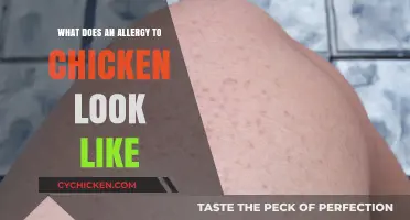 Unveiling the Symptoms: What Does an Allergy to Chicken Look Like?