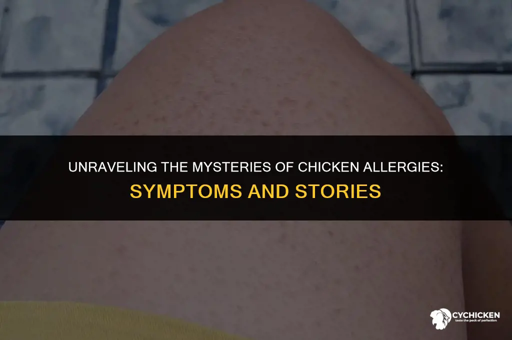 what does being allerigic to chicken fel like