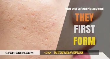 How Do Chicken Pox First Appear?