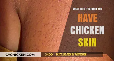 Understanding Keratosis Pilaris: Chicken Skin Explained