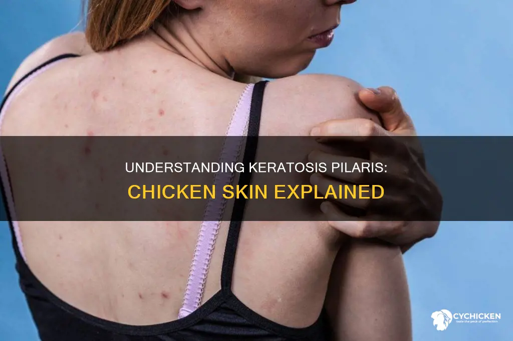 what does it mean if you have chicken skin