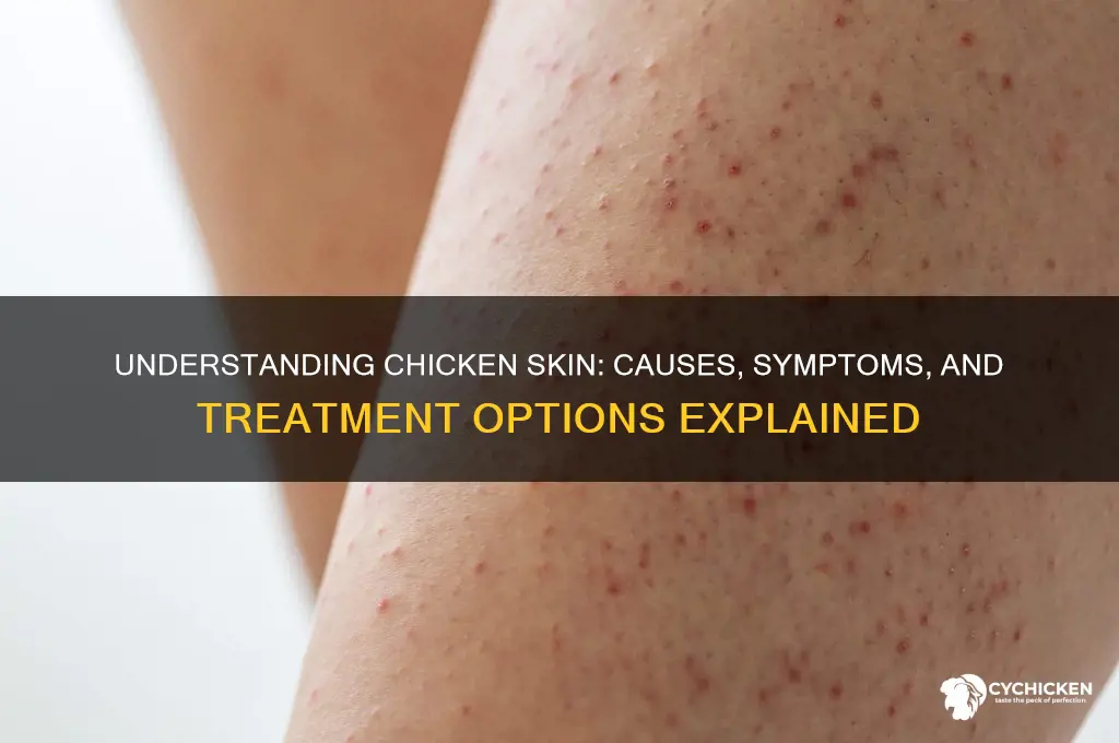 what does it mean to have chicken skin