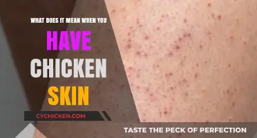 Understanding Keratosis Pilaris: Chicken Skin Explained