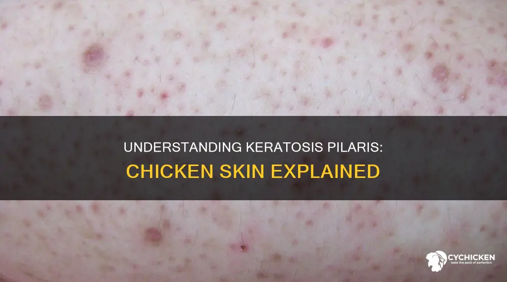 what does it mean when you have chicken skin