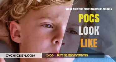 Early Chickenpox Symptoms: Spotting the First Signs and Rash Appearance