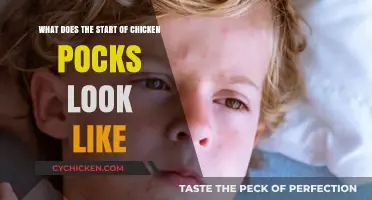 Early Signs of Chickenpox: Spotting the First Symptoms and Rash Appearance