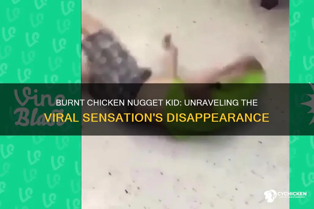 what happened to the burnt chicken nugget kid