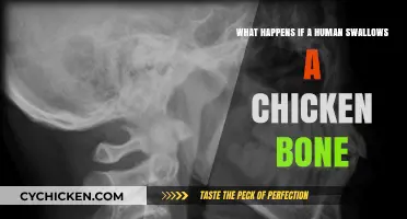 Swallowing Chicken Bones: What are the Risks?