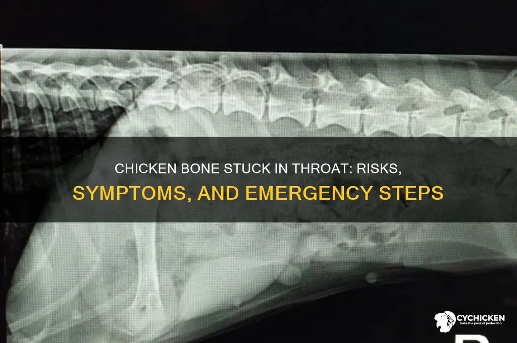 what happens if chicken bone stuck in throat