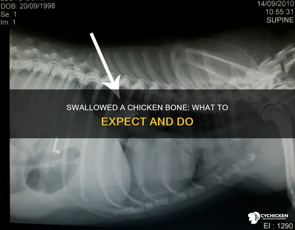 what happens if i accidentally swallow a chicken bone