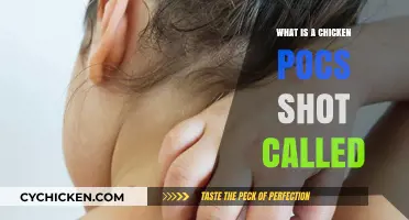 Understanding the Chickenpox Vaccine: What's It Called and Why It's Important
