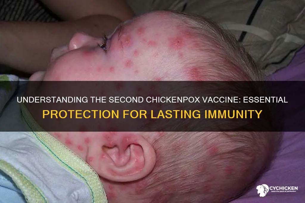 what is a second action chicken chickenpox vaccine