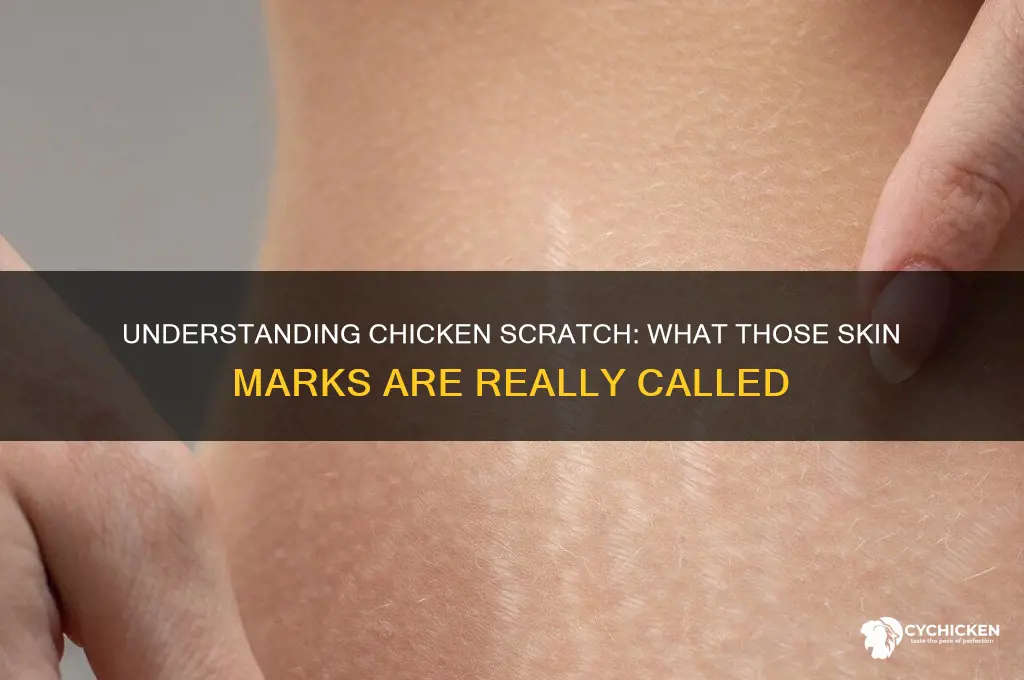 what is chicken scratch called on the skin