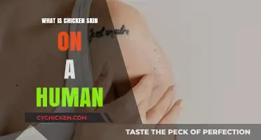 Understanding Chicken Skin on Humans: Causes, Symptoms, and Treatments