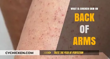 Understanding Chicken Skin: Keratosis Pilaris on the Back of Arms