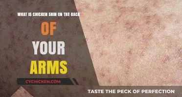 Understanding Keratosis Pilaris: Chicken Skin on Arms