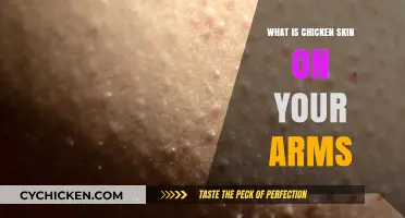 Understanding Chicken Skin: Causes and Treatments for Keratosis Pilaris on Arms