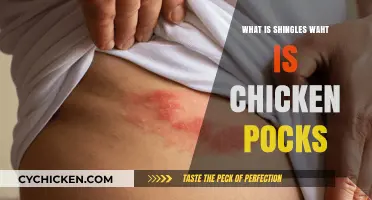 Understanding Shingles and Chickenpox: Causes, Symptoms, and Prevention Tips