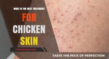 Effective Treatments for Chicken Skin: Smooth Solutions for Keratosis Pilaris