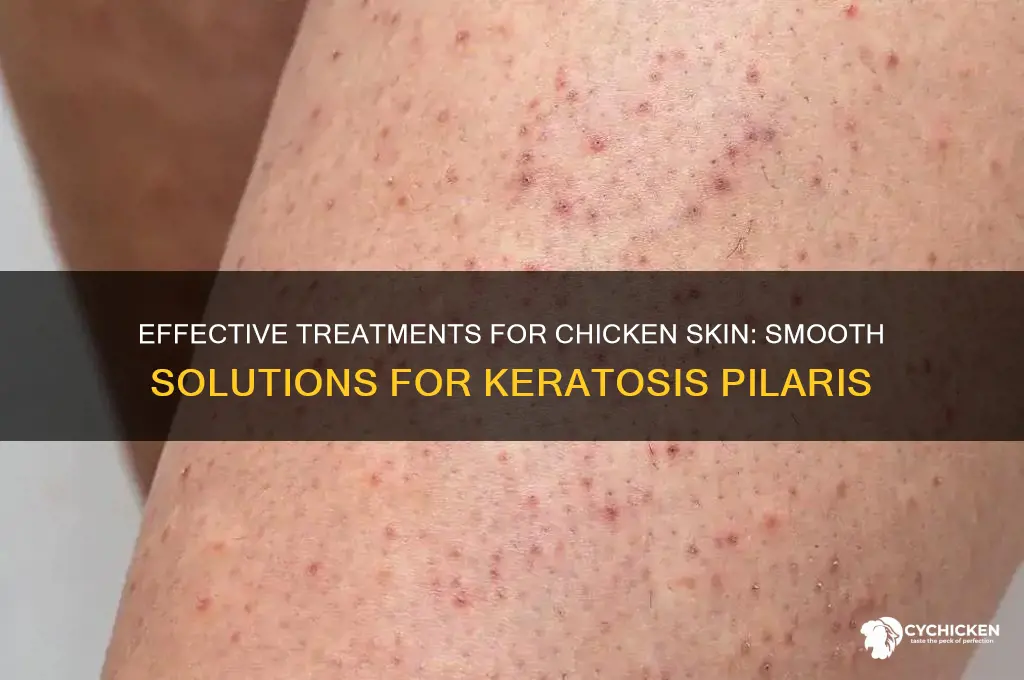 what is the best treatment for chicken skin