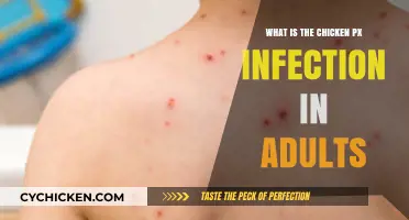 Understanding Chickenpox in Adults: Symptoms, Risks, and Treatment Options