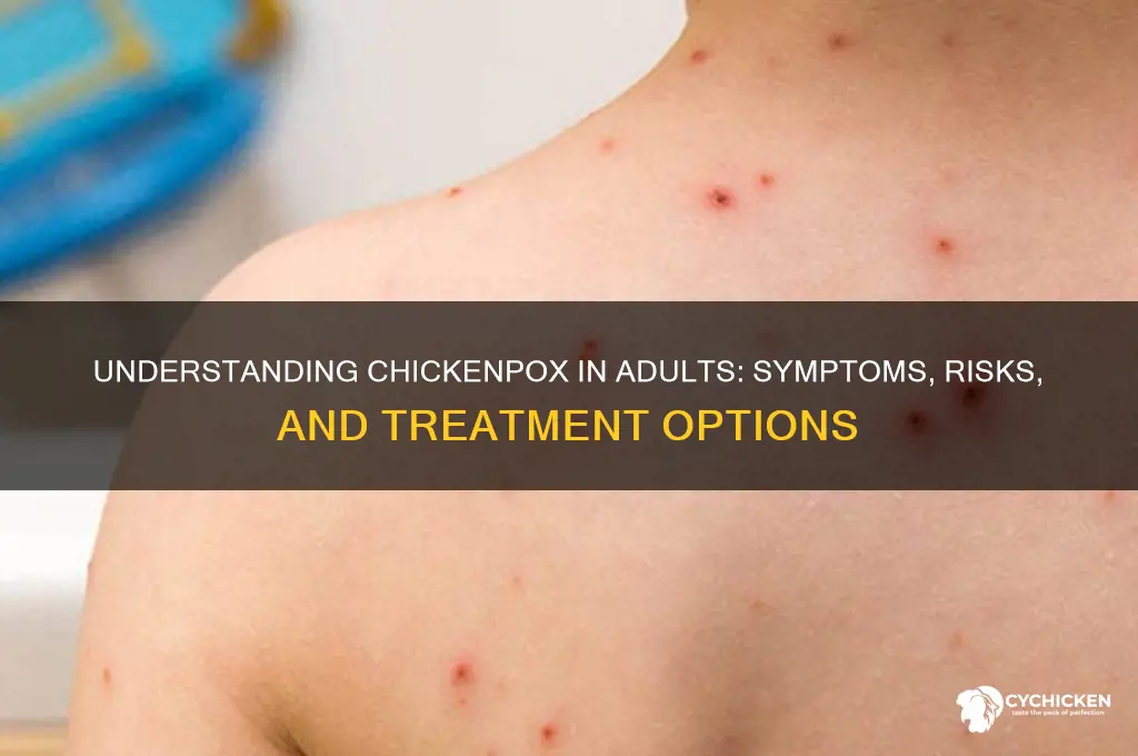 what is the chicken px infection in adults