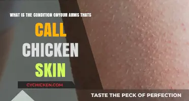 Chicken Skin: What's That on Your Arms?