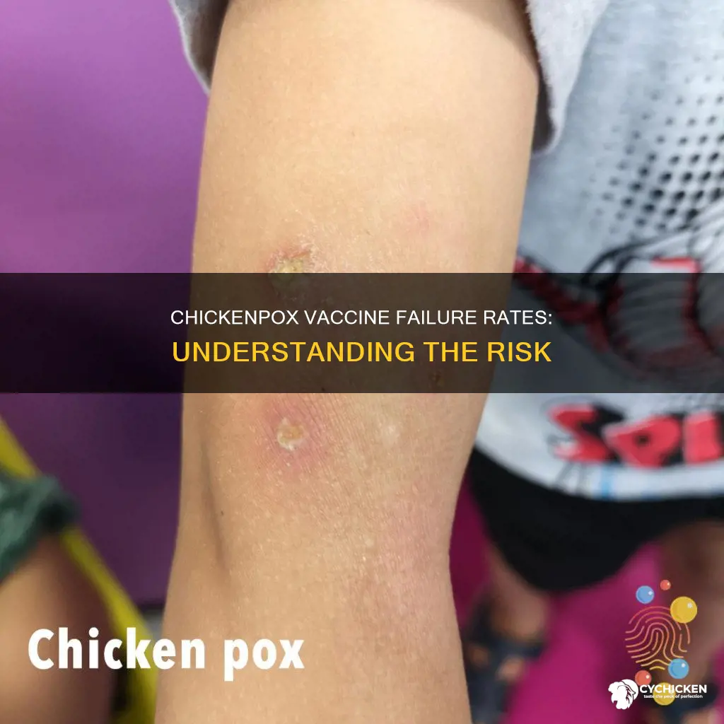 what is the failure rste of chicken chickenpox vaccine