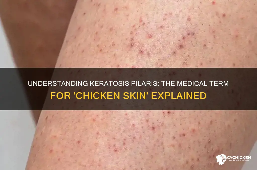 what is the medical term for chicken skin