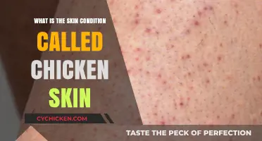 Understanding Keratosis Pilaris: The Common Skin Condition Called Chicken Skin