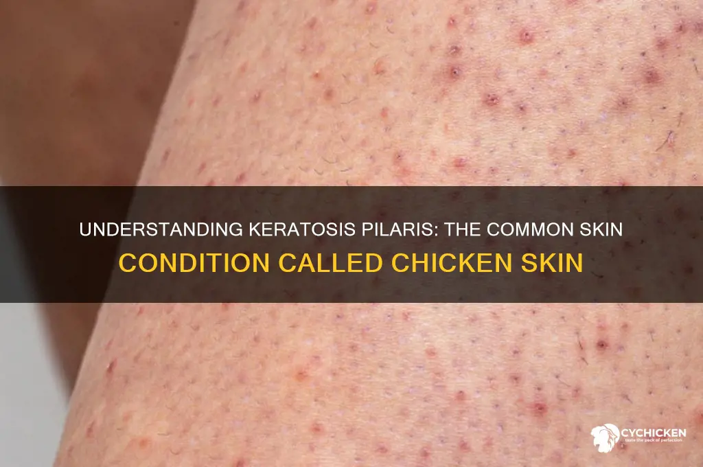 what is the skin condition called chicken skin