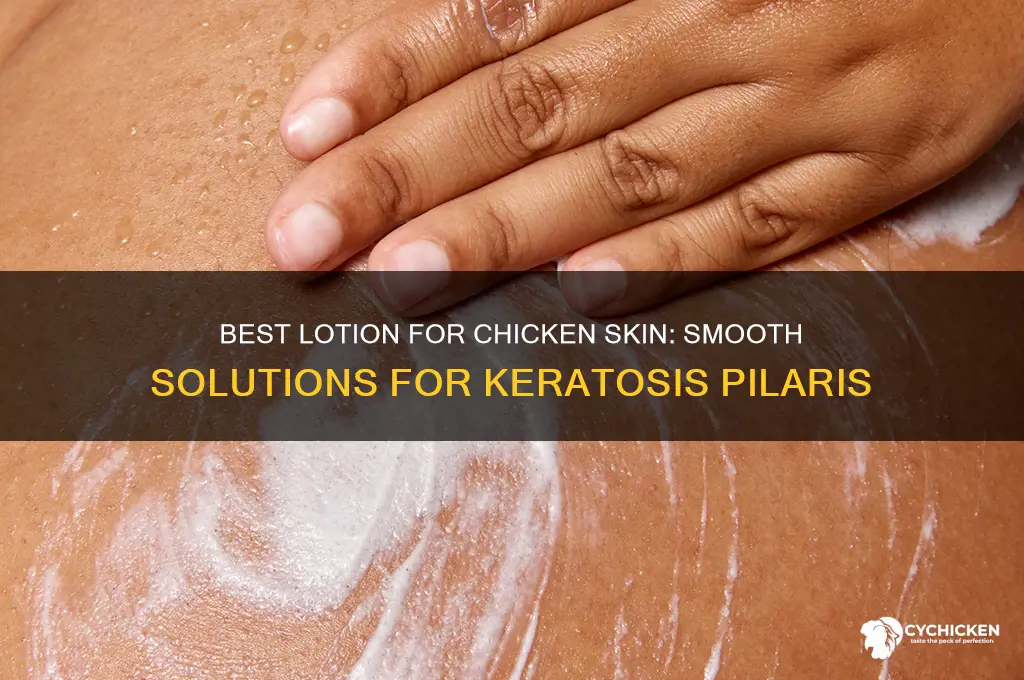 what lotion is best for chicken skin