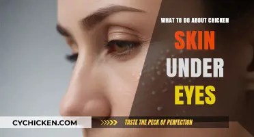 Banish Chicken Skin Under Eyes: Effective Treatments and Prevention Tips
