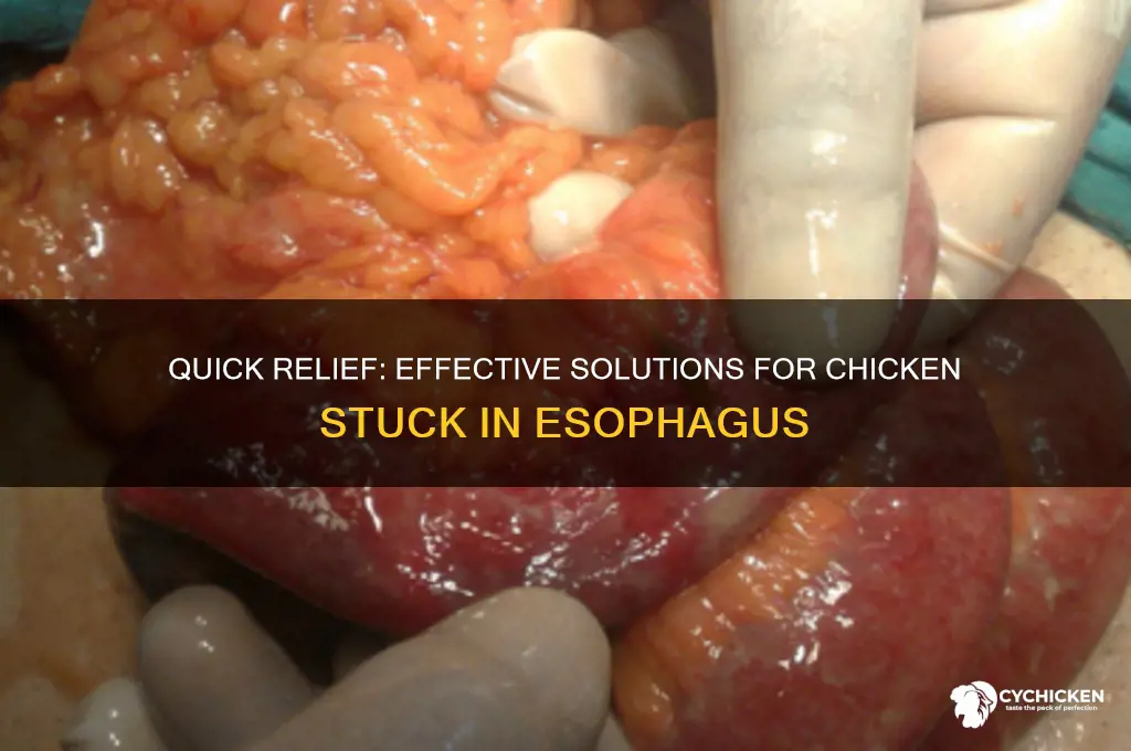 what to do for chicken stuck in esophagus