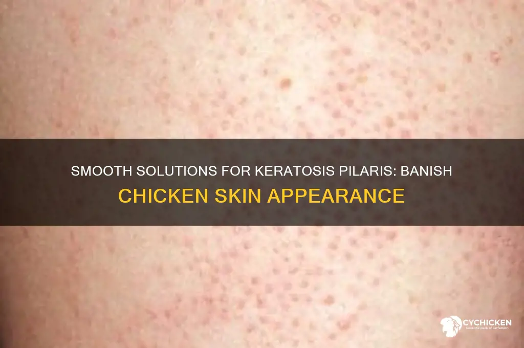 what to do when your skin looks like chicken skin